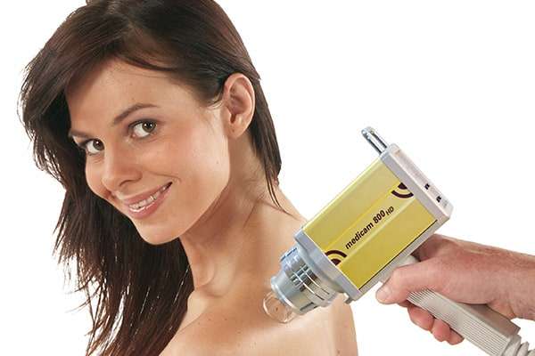 Videodermatoskopia