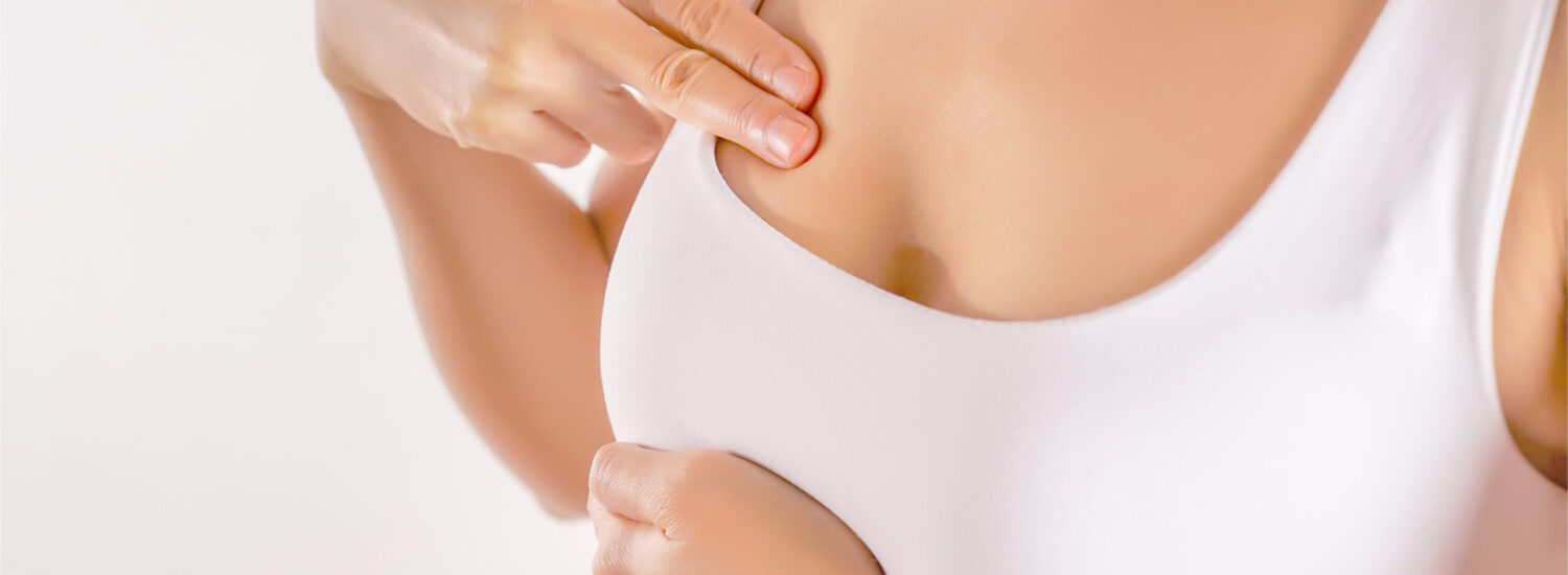 breast augmentation