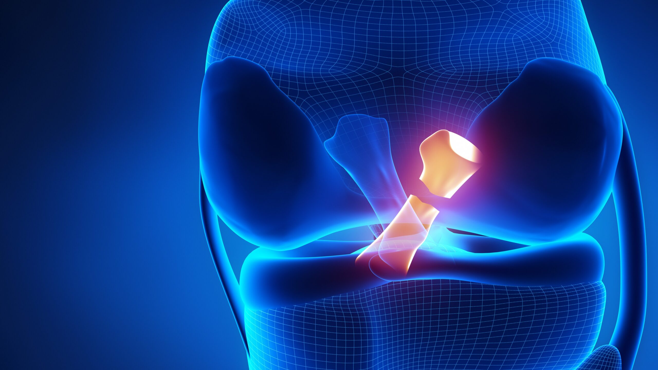 knee ligament reconstruction Wilmed